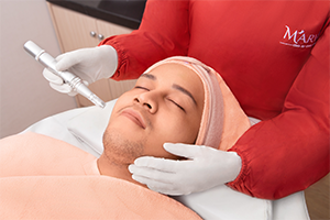 Dermapen