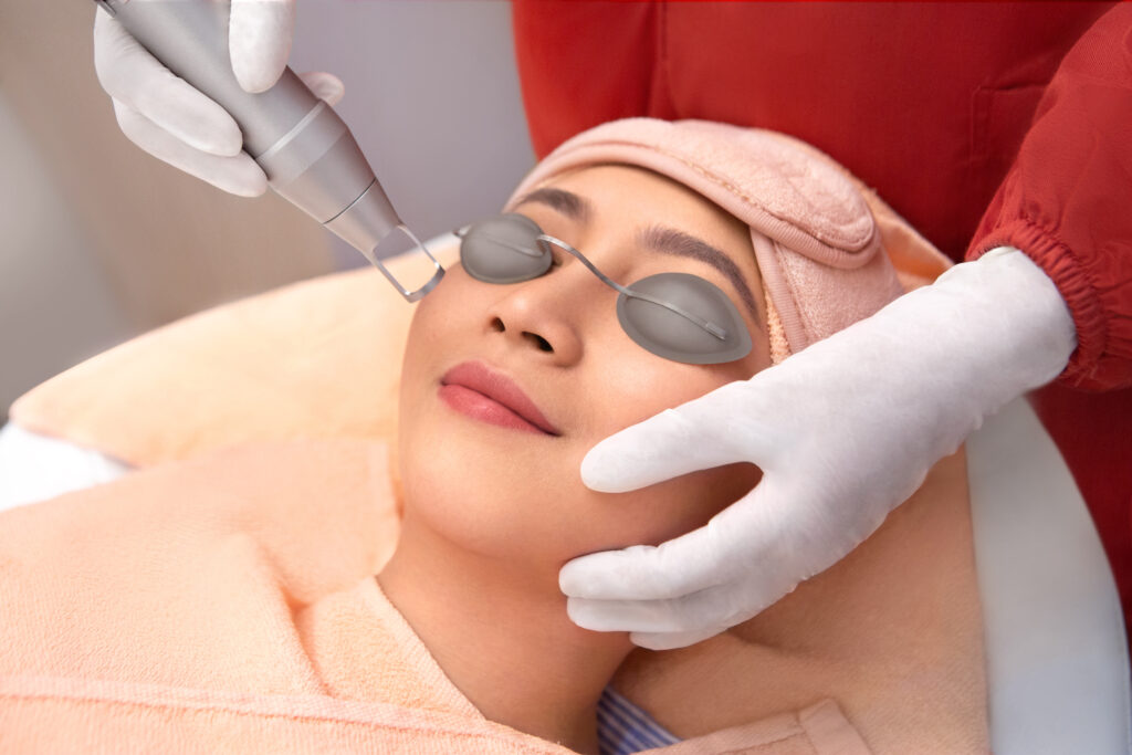 Laser treatment