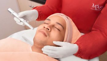 Copy of Marvee Clinic_Dermapen – FINAL (1) Copy of Marvee Clinic_Dermapen - FINAL (1)