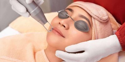Laser Treatment Cara membuat kulit cerah