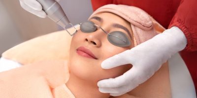 Laser treatment Laser treatment