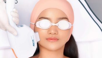 Marvee - 1 - Revisi 1