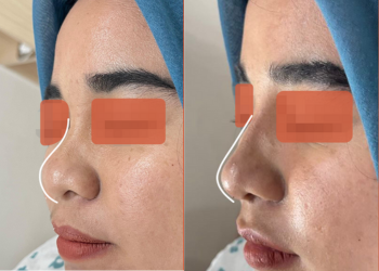 Untitled design (62)