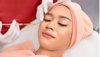 PRP Treatment PRP untuk atasi bekas jerawat, anti aging, dan mencerahkan kulit